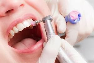 profilaxie-dentia